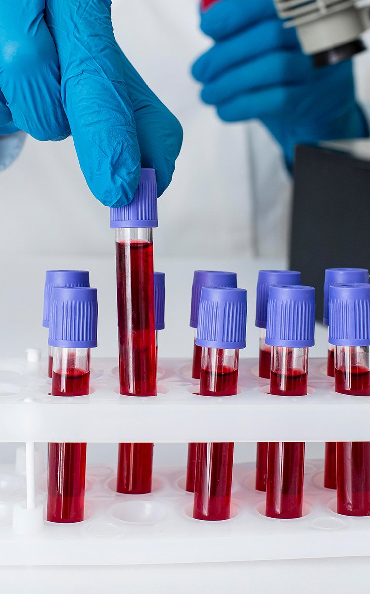 Blood Bag Monitoring